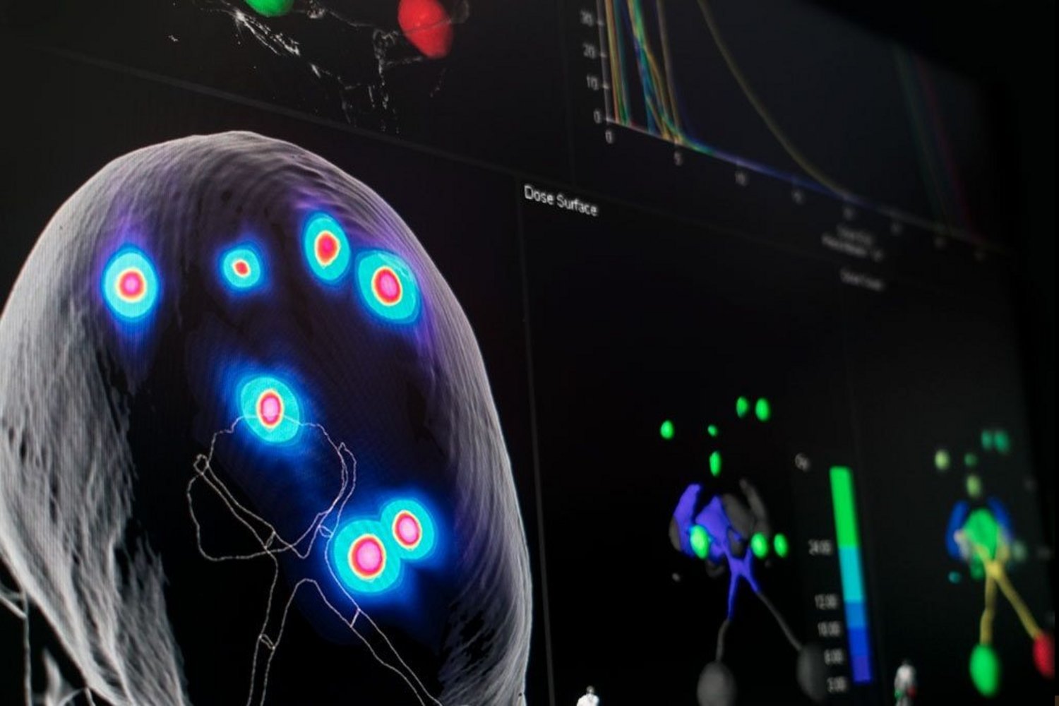 Brain lab